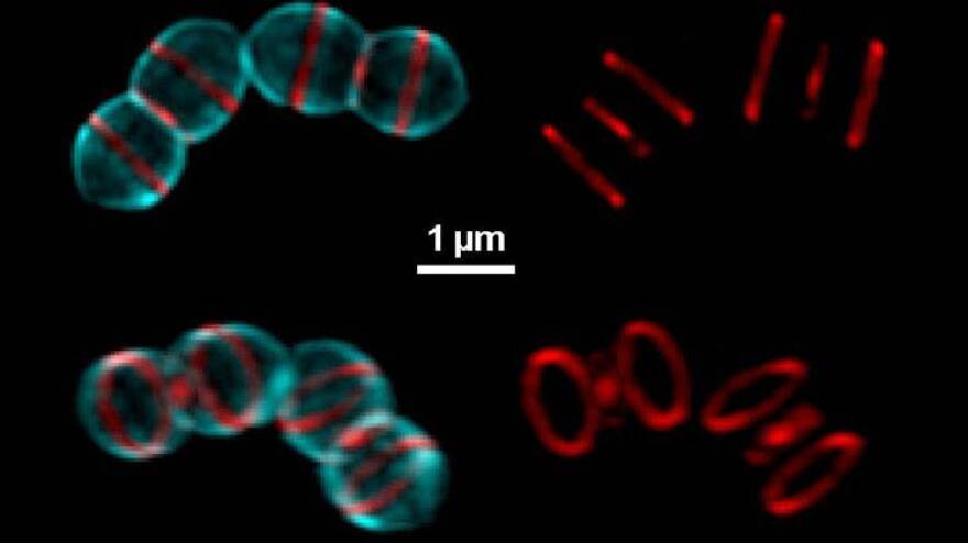 Regions of active cell wall synthesis shown by high-resolution imaging of the bacterial pathogen Streptococcus pneumoniae. Long-term labeling is revealed with blue FDAA and short-time labeling with red FDAA.