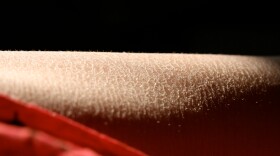It is the water content of our outermost layer of skin that makes the difference between normal skin and dry skin.