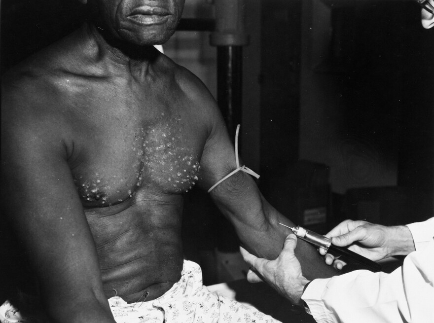 A man receives an injection during the Tuskegee Syphilis Study in the 1930s. A lingering mistrust of the medical system among many Black people is rooted in the infamous study.