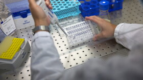 A researcher manipulates proteins in a laboratory of the Tours University. The University of Tours and the French National Research Institute For Agriculture, Food And Environment (INRAE) announced on Sept. 9, 2021, the design of a nasal spray vaccine candidate against COVID-19. (Guillaume SouvantT/AFP via Getty Images)