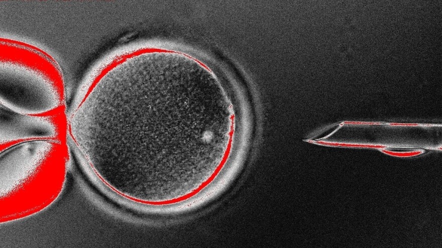 An image of researchers at Oregon Health & Science University removing the nucleus from the mother's cell before it's inserted into the donor's egg cell.