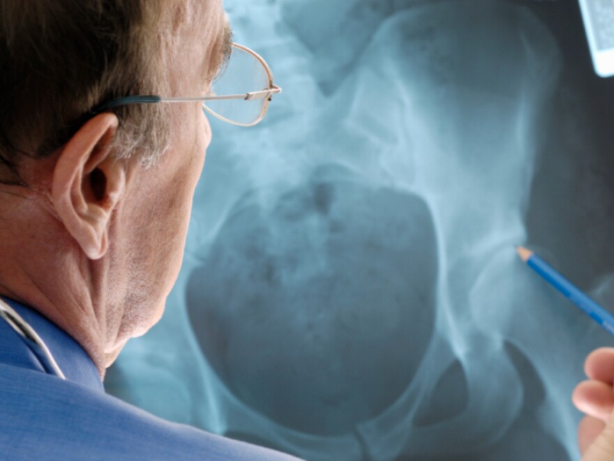 Artificial hips have been a big advancement in treating debilitating arthritis. But there have been reports of medical issues — some serious — in patients with all-metal implants.