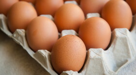 Whole eggs contain dietary cholesterol, but also protein and other nutrients.