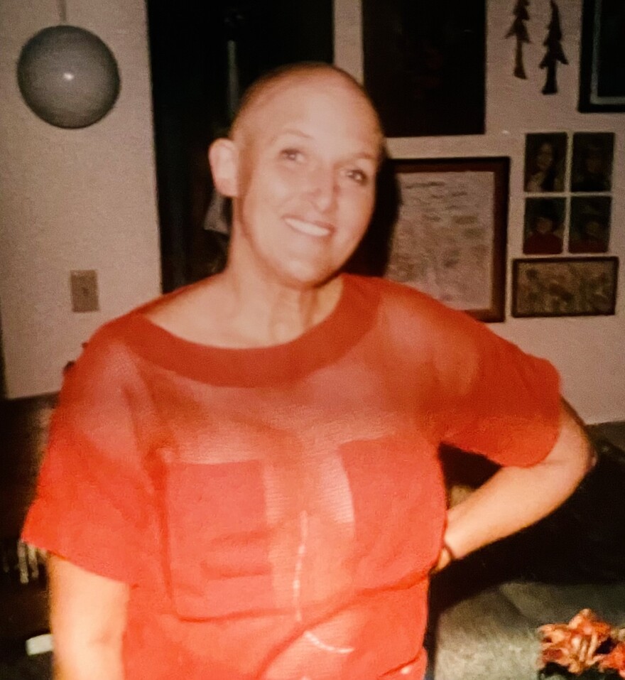 A woman who has lost her hair from chemotherapy, smiles for the camera. 