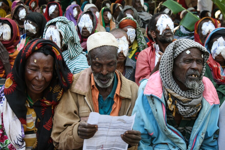 After cataract surgery to restore his sight, this man can now read his medical chart. Other patients behind him are about to have the bandages removed from their eyes.