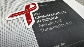 The analysis from the Williams Institute at the UCLA School of Law looked at the risk of transmission associated with Indiana’s six criminalization laws. The report found the laws were based on outdated science on how HIV is transmitted.