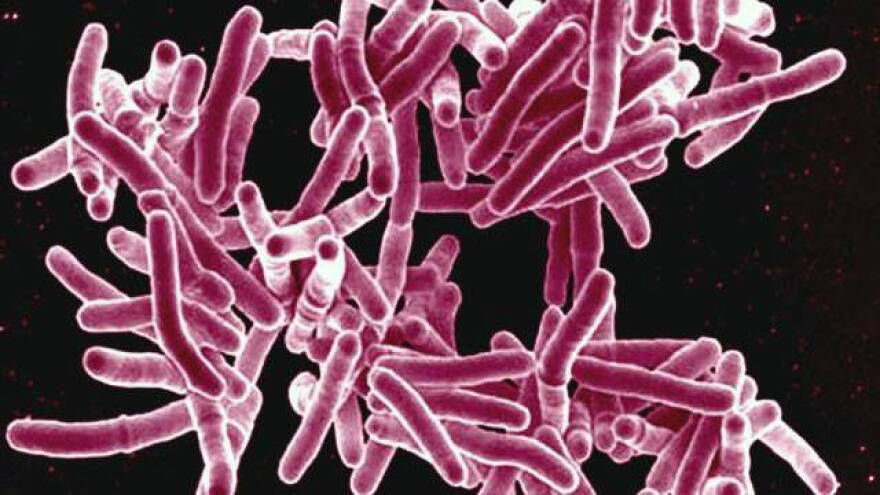 Tuberculosis is spread through the air.