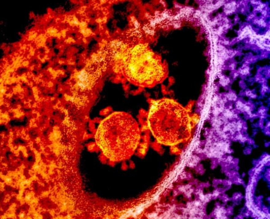 A colorized micrograph of MERS, a member of the coronavirus group along with the 2019 Wuhan strain