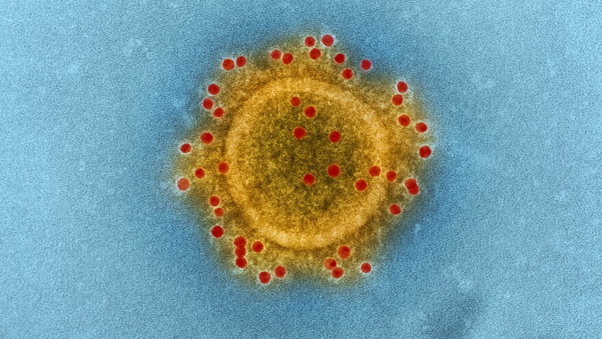 The Middle East respiratory syndrome coronavirus, which causes MERS, is one of the microbes that has sparked research controversy.