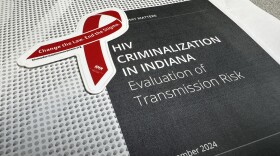 The analysis from the Williams Institute at the UCLA School of Law looked at the risk of transmission associated with Indiana’s six criminalization laws. The report found the laws were based on outdated science on how HIV is transmitted.