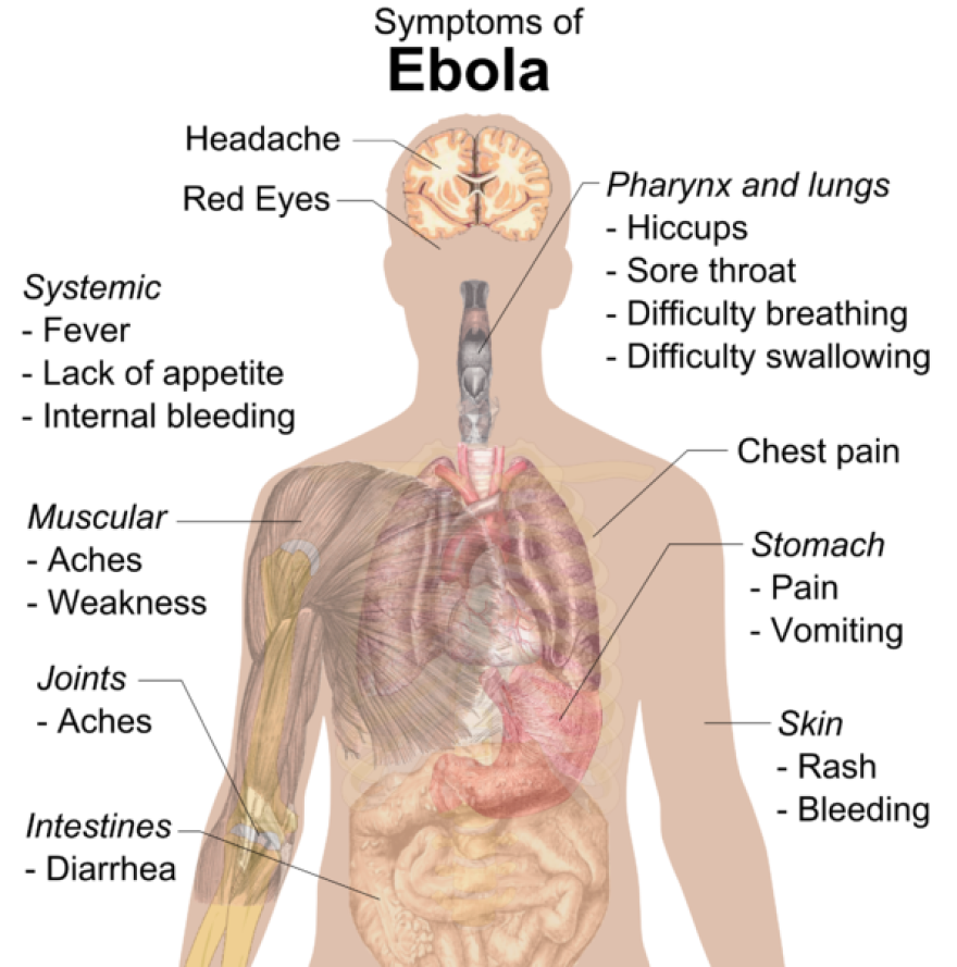 Symptoms_of_ebola.png
