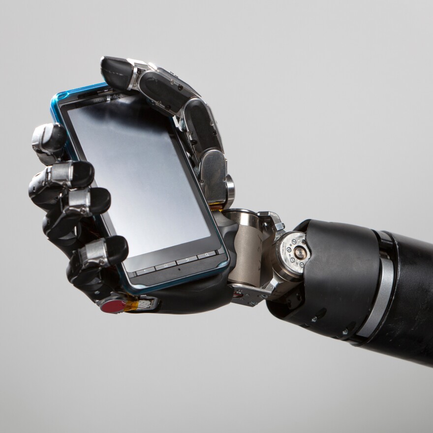 Johns Hopkins' MPL prosthetic arm and hand can grip up to 70 pounds.