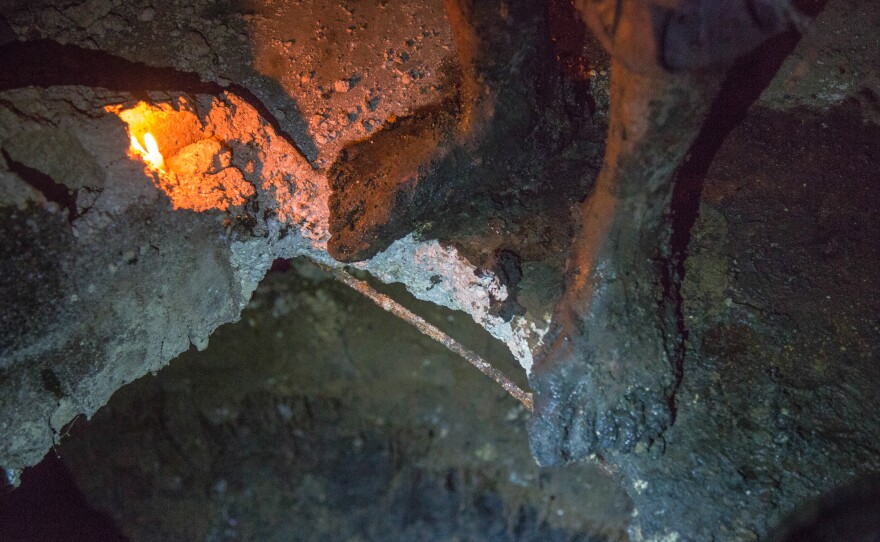 <em>Bayakou</em> are frequently wounded on the job. Men describe deep cuts, missing toenails and persistent infections from exposure to human waste.