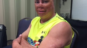 Wounded Iraqi War Vet Shilo Harris