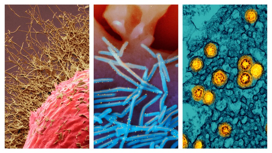 From left: 1) Colored scanning electron micrograph (SEM) of a human cell infected with H3N2 flu virus (gold filamentous particles). 2) Scanning electron micrograph of human respiratory syncytial virus (RSV) virions (colorized blue) that are shedding from the surface of human lung epithelial cells. 3) Transmission electron micrograph of SARS-CoV-2 Omicron virus particles (gold).
