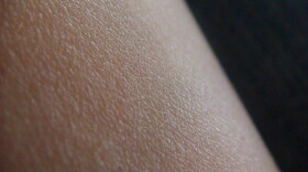 Did you know that researchers have discovered that there are at least 250 kinds of bacteria that live on our skin?