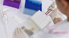 A researcher works on the diagnosis of suspected coronavirus COVID-19 cases in Belo Horizonte, state of Minas Gerais, Brazil, on March 26, 2020. (DOUGLAS MAGNO/AFP via Getty Images)