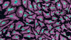 HeLa cells, commonly used in research, were derived from cervical cancer cells taken in 1951 from Henrietta Lacks without her permission.