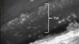 The image shows a portion of the eye in detail using methods developed at IU.
