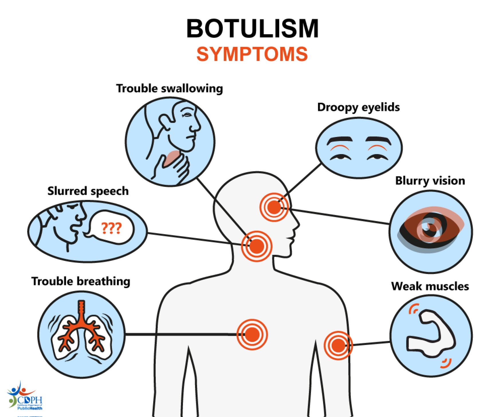 Botulism Immunity Peoria's resident botulism historian is out with a new book on the rare ...