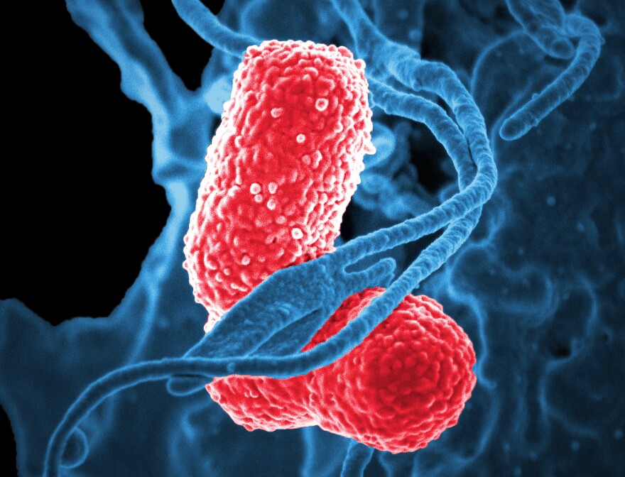 A newly detected type of <em>Klebsiella pneumoniae</em> bacteria (in red) has acquired genes that make it more deadly.