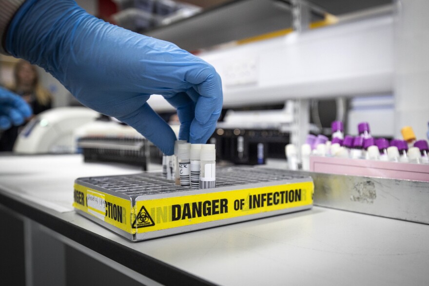 Clinical support technician Douglas Condie extracts viruses samples as analytic work continues to examine the genetic structure of a virus in the coronavirus testing laboratory at Glasgow Royal Infirmary, Glasgow, Scotland, Wednesday Feb. 19, 2020.