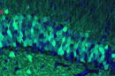 These cells in the hippocampus of our brains help in the transition between short-term and long-term memory