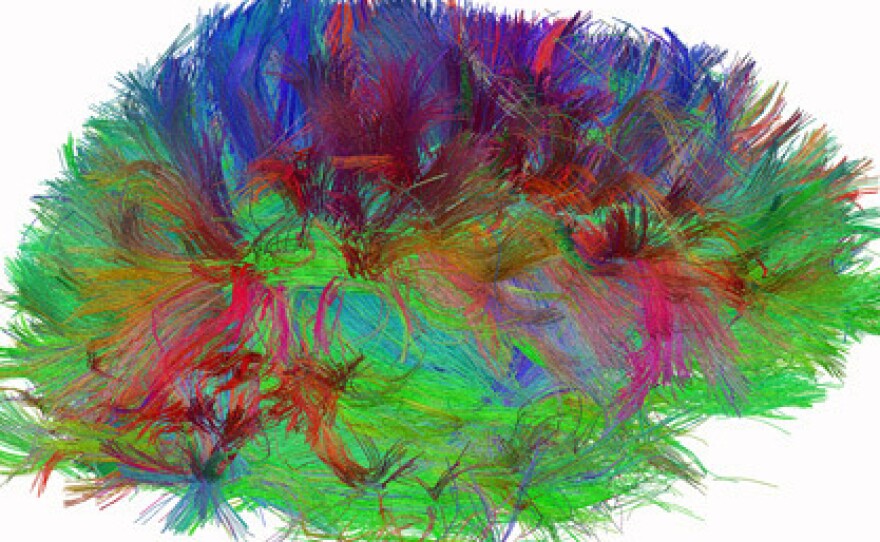 A diffusion spectrum image shows the brain wiring in a healthy human adult.