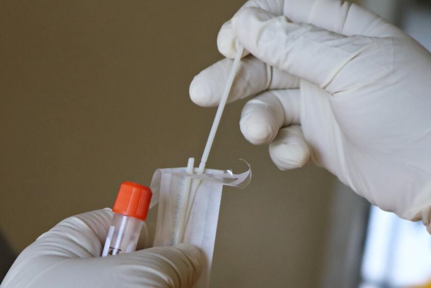 Ventura and Santa Barbara Counties are seeing skyrocketing COVID-19 case numbers coming out of the holidays.