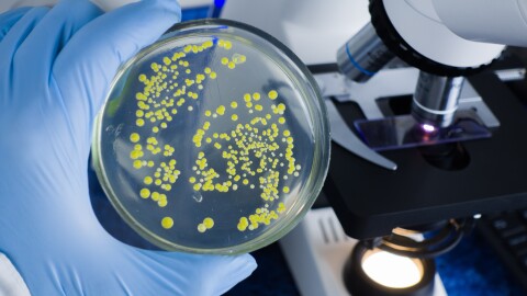 An overhead, close-up shot shows a gloved hand holding a round glass petri dish filled with clear agar and numerous distinct, circular yellow bacterial colonies. In the background, a modern white and black microscope features a glowing light source and a slide positioned on the stage, set against a dark blue surface.