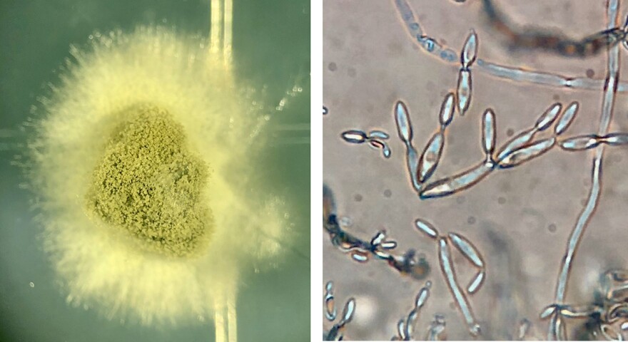 Cladosporium colonies emerge from a Twinkie sample (left) and viewed at 20 times magnification using a compound microscope.