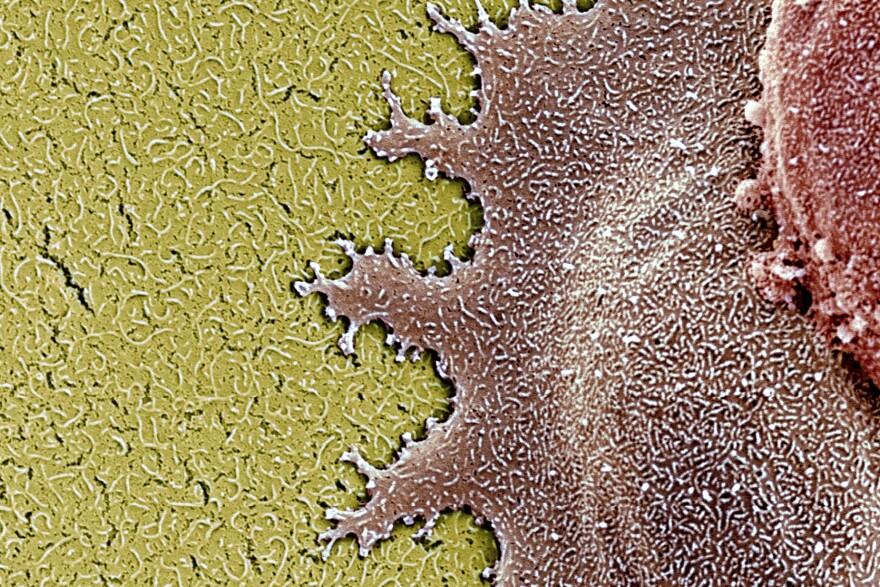 A colored scanning electron micrograph of two human retinal stem cells, shown in brown and red.