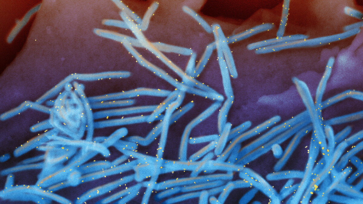 Winter 2023: The state of infectious diseases in Southern Nevada - Vimarsana News