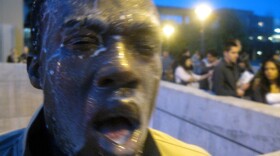 Nnaemeka Alozie, campaign manager for California congressional candidate David Steinman, poured milk on his face Tuesday after being pepper sprayed during the incident at Santa Monica College. 