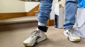 An ankle monitor worn by a man detained during an Immigration and Customs Enforcement operation in Lake Placid on May 28, 2026