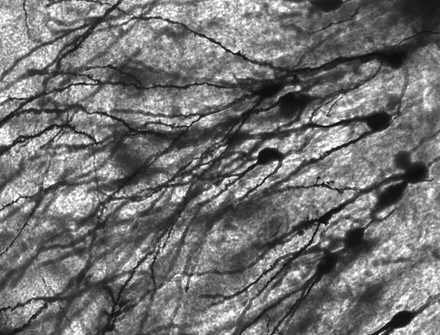 The image Golgi-stained neurons in human hippocampal tissue. The stained neurons are black and sinuous and snake through grey tissue.