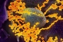 SARS-CoV-2 causes the illness known as COVID-19. The virus, in yellow, was isolated from a patient in the U.S. and grown at Rocky Mountain Laboratories in Hamilton, Montana.
