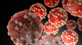 Depiction of measles virus. 