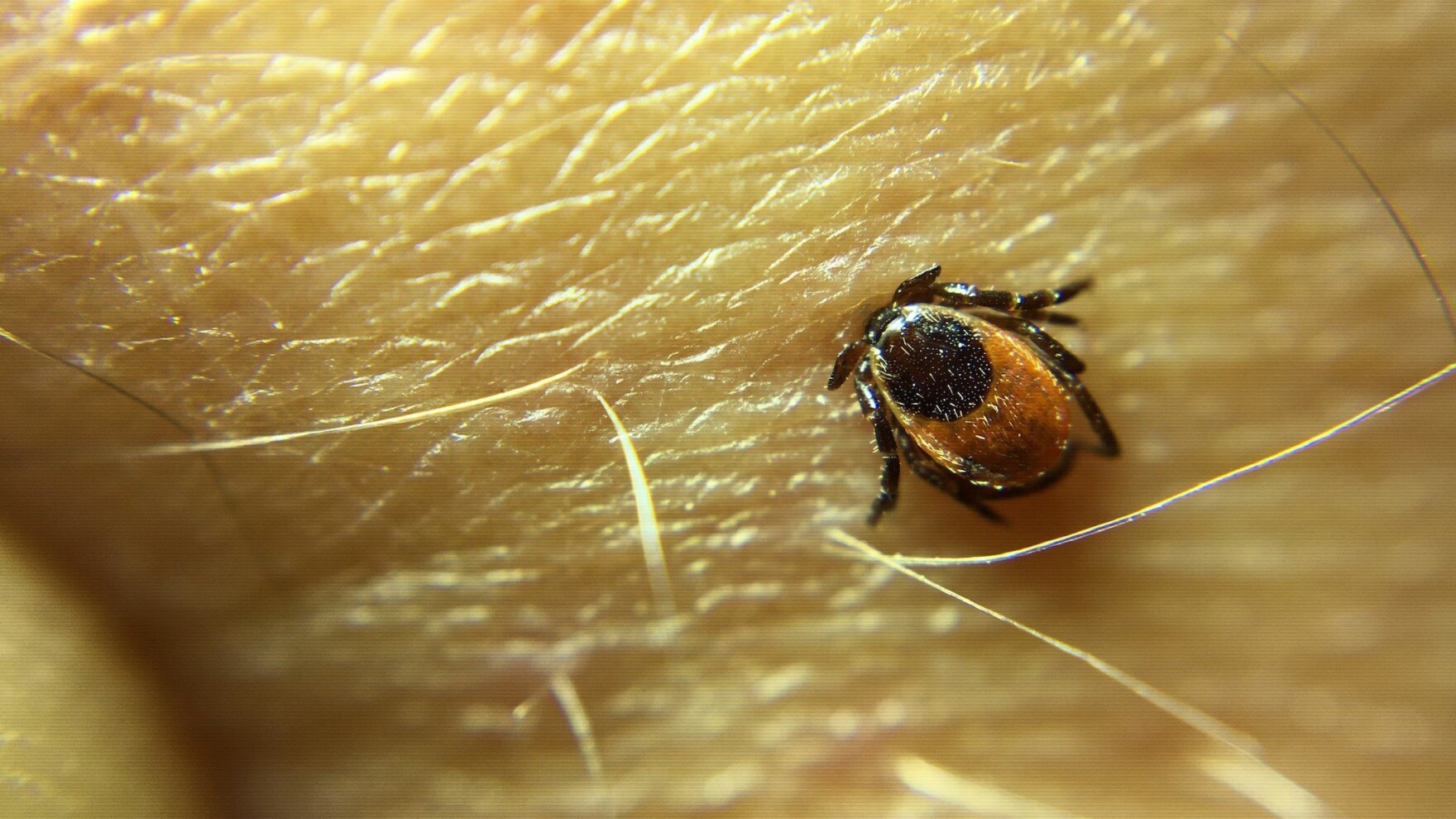 Onondaga County continues support of Upstate Tick Testing Lab | WAER