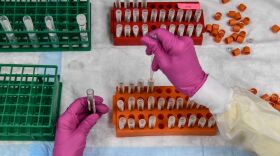 A lab technician sorts blood samples for a COVID-19 vaccination study at the Research Centers of America in Hollywood, Fla., on Aug. 13.