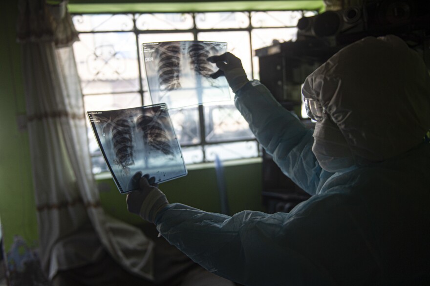 A doctor checks a lung X-ray plate while visiting a patient with COVID-19 in Comas, in the northern outskirts of Lima, Peru.