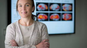 Dr. Shannon Risacher is lead author of a study that links long-term use of certain medications to a higher risk of progression to Alzheimerâ€™s disease.