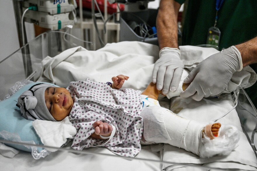 Newborn baby Amina is treated for the gun wound in her right leg incurred during the May 12, 2020 attack on a maternity hospital in Kabul. After being rescued, she was brought to the French Medical Institute for Children for surgery.