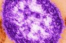 This undated image made available by the Centers for Disease Control and Prevention on Feb. 4, 2015 shows an electron microscope image of a measles virus particle, center. (Cynthia Goldsmith/Centers for Disease Control and Prevention via AP)