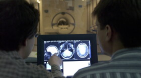 Some patients have had success treating movement disorders with neurostimulators — devices implanted in the brain during a procedure called deep brain stimulation surgery. (Jens Schlueter/DDP/AFP via Getty Images)