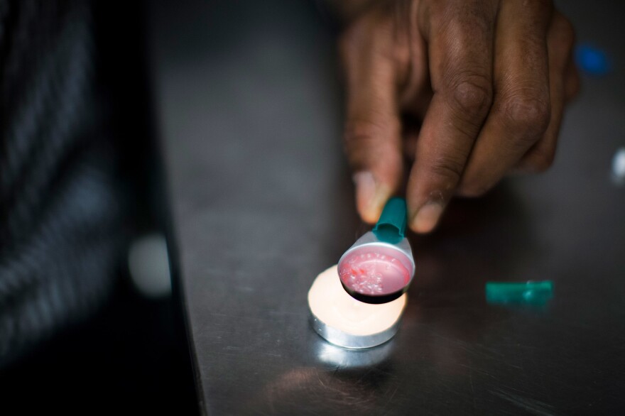 A drug user prepares a hit of heroin inside VANDU's supervised injection room.