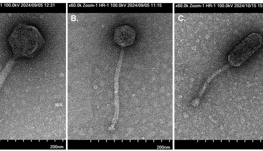 From left to right, newly discovered bacteriophages Revolver, Alamo and GiddyUp are seen under a transmission electron microscope.