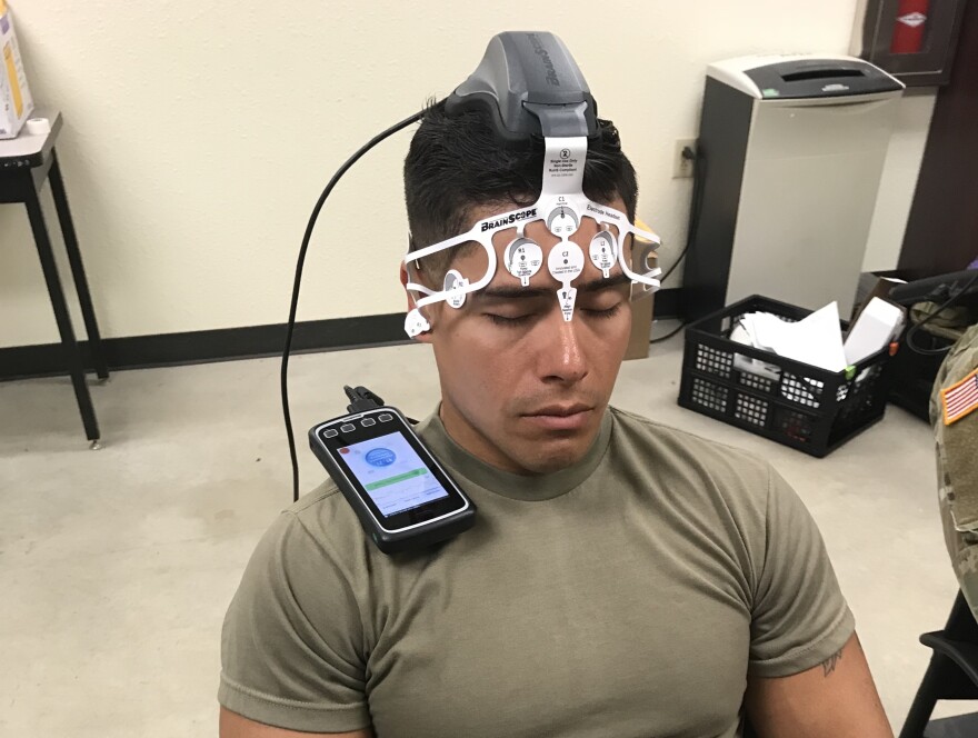 A soldier at Fort Leonard Wood is tested for TBI using the experimental BrainScope, part of research going on at the base and Phelps Health in Rolla.