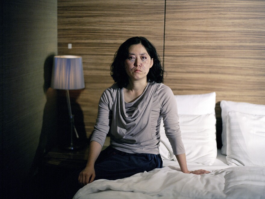 Photographer Ji Yeo took portraits of women in South Korea recovering from plastic surgeries.