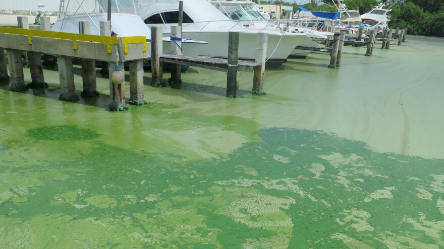 Blue-green algae, known as cyanobacteria, can produce dangerous toxins and have been growing in ponds across the Cape. It's fueled in large part by nutrients that seep out of septic systems.